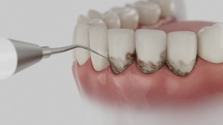 Reliable Tooth Extraction contractor in Charlevoix, MI by Smile Center Dentistry